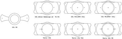 From inception to innovation: bibliometric analysis of the evolution, hotspots, and trends in implantable collamer lens surgery research